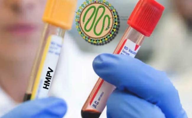 State Health Department prepared for HMPV virus